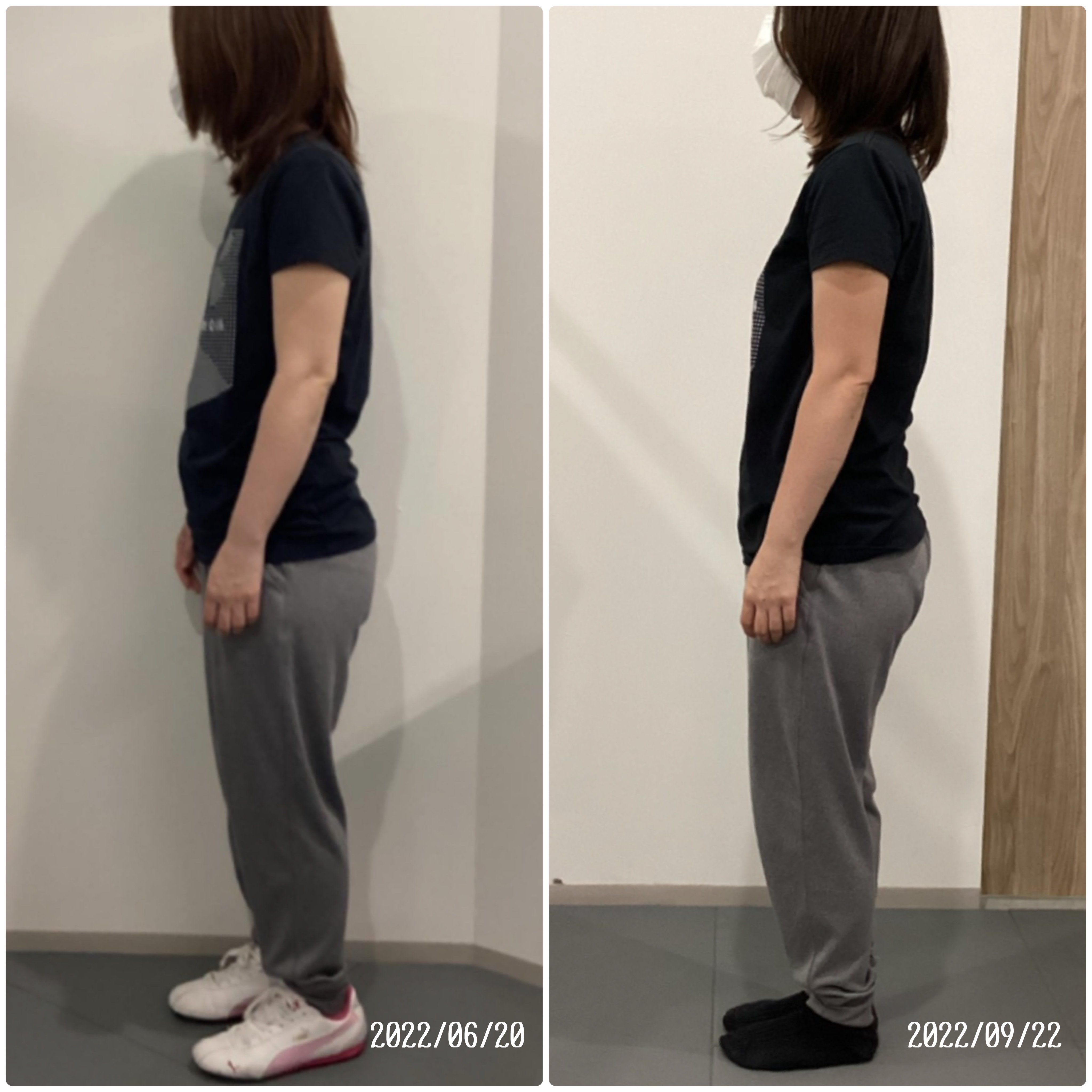 Before/After